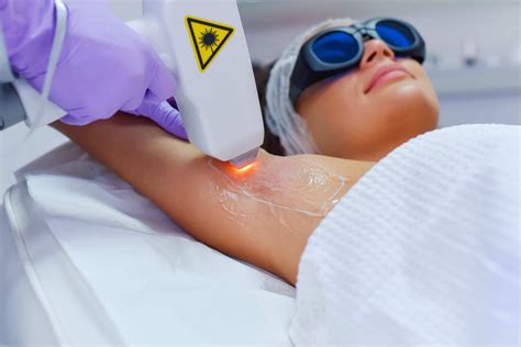 Laser Hair Removal .